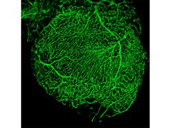 Coroary vessels