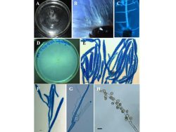 Dr. Parasnath Singh List of Publications Image4